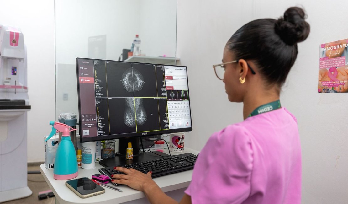 Rio Largo se destaca na saúde da mulher com mais de 5 mil exames realizados no primeiro semestre de 2025