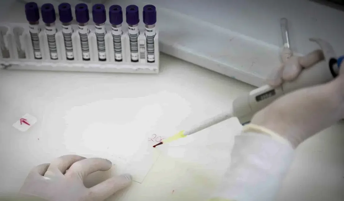 Paciente em SP com suspeita de ebola testa positivo para meningite