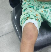 Trauma e hematomas: menino vítima de maus-tratos em Maceió é entregue ao pai