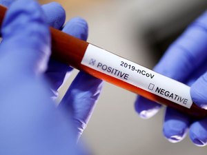 Catalunha: cientistas desenvolvem medicamento contra novo coronavírus