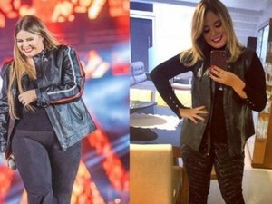 Marília Mendonça pretende refazer cirurgias plásticas