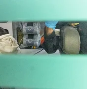 Médico de Bolsonaro diz que broncopneumonia é “potencialmente mortal”