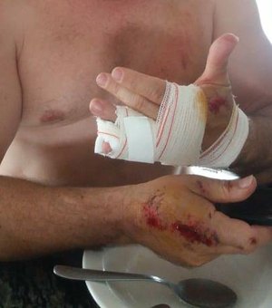 Fotógrafo é atacado por 5 cachorros quando transitava em motocicleta, em Arapiraca