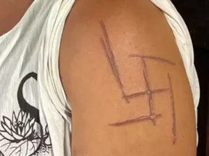 Mulher trans é marcada por suástica nazista após ser espancada por namorado e patrões