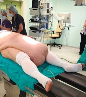 Tumor abdominal de 35 kg impede homem de urinar e choca médicos