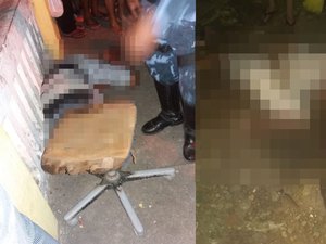 Vítima de atentado à bala em Porto Calvo retira projetil da cabeça