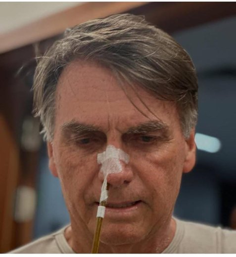 Bolsonaro tem dreno retirado, não tem febre e segue com boa evolução clínica, diz boletim
