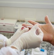 Alagoas registra aumento de casos confirmados de HIV