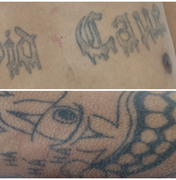 Hospital de Emergência do Agreste procura familiares de paciente identificado apenas como Rafael