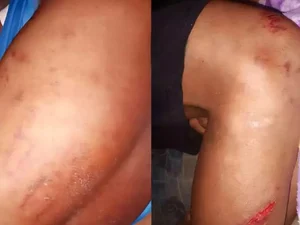 Família acusa Guarda Municipal de espancar jovem em São José da Laje: 'desumano'