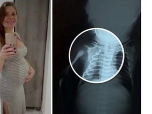 Morre o bebê Arthur, que foi baleado dentro do útero da mãe no Rio