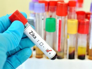 Planos de saúde terão que pagar exames de Zika a partir de hoje