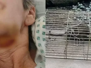 Ratazana ‘alucinada’ ataca idosa e deixa rosto desfigurado durante a noite