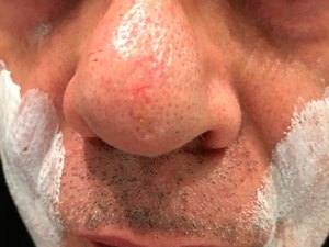 Walcyr Carrasco passa pasta de dente no rosto e posta foto na web