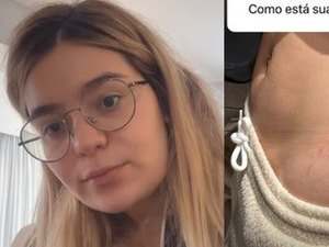 Viih Tube mostra estrias 4 meses após parto e dá detalhes de dieta: '200g de frango no café da manhã'