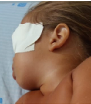 Médico avalia bebê que sofreu acidente doméstico e diz que sua visão pode ser restabelecida