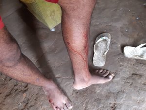 Homem sofre tentativa de assassinato na zona rural de Messias