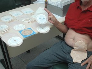Defensor cobra restabelecimento da distribuição das bolsas de colostomia a pacientes