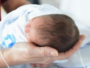 Saúde: Alagoas garante cuidado aos bebês com microcefalia