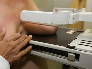 Número de mamografias aumenta em 37% no país