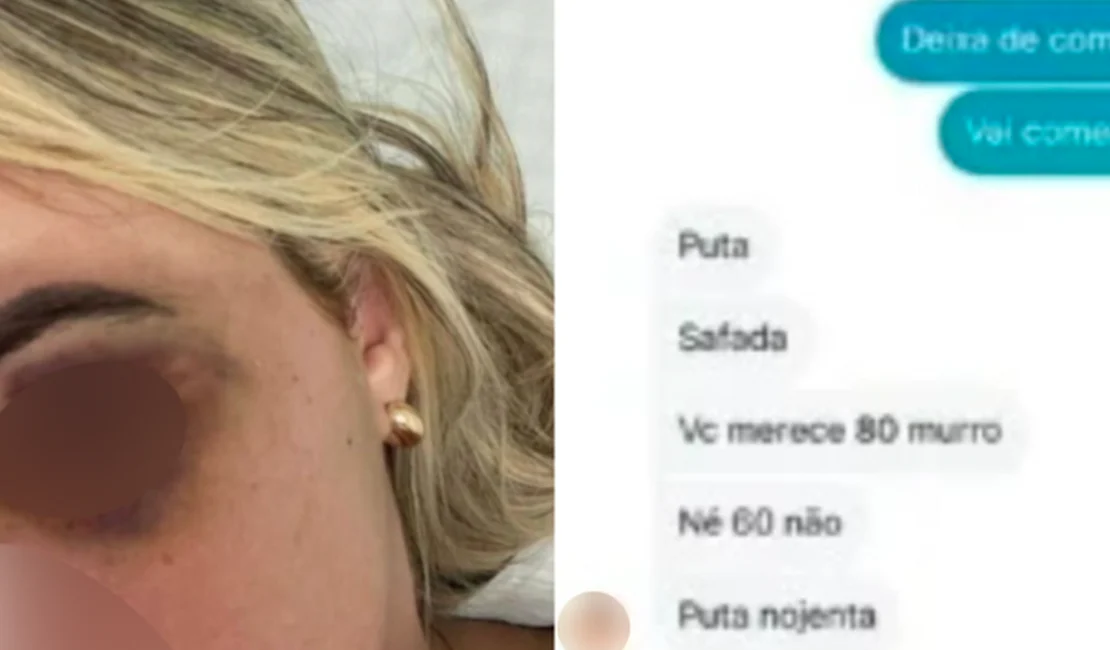 Mulher sofre tentativa de feminicídio após ser atropelada e agredida pelo ex-companheiro em Olivença