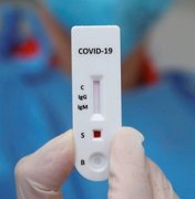 Hospital de Coruripe que atende pacientes de Covid-19 pelo SUS cobra R$ 300,00 por teste rápido 
