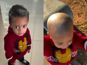 Criança usa creme depilatório na cabeça e perde o cabelo