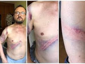 “Quase fui assassinado”: professor de 64 anos foi espancado por PMs na Alesp