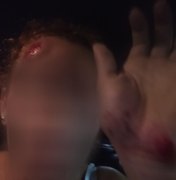 Motorista de aplicativo é arremessada do próprio carro durante assalto, em Rio Largo