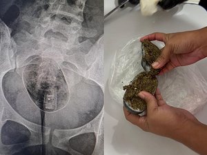 Mulher tenta entrar em presídio com drogas e pen drive nas partes íntimas e agora precisa cirurgia