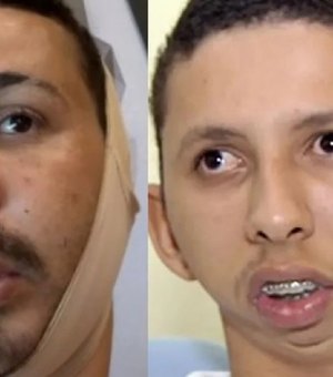 Carlinhos Maia é condenado a pagar R$ 200 mil por piada sobre má-formação óssea