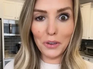 Influencer fica com olho arregalado após reação inesperada ao botox
