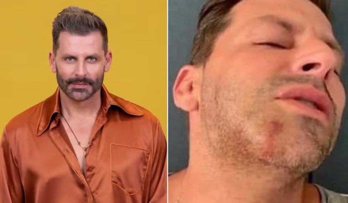 Convulsões de Henri Castelli no BBB podem ter relação com agressões sofridas em Alagoas