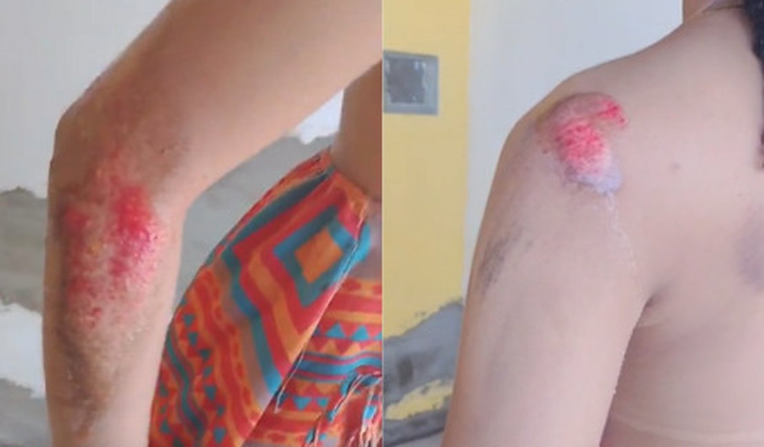 Jovem pula de moto por aplicativo após suspeitar de tentativa de estupro