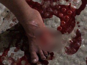 MP acompanha caso de PM que teria atirado em jovem sem motivo, em Maceió