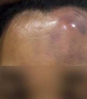 Polícia investiga conduta de militares denunciados por agredir mulher em Maceió