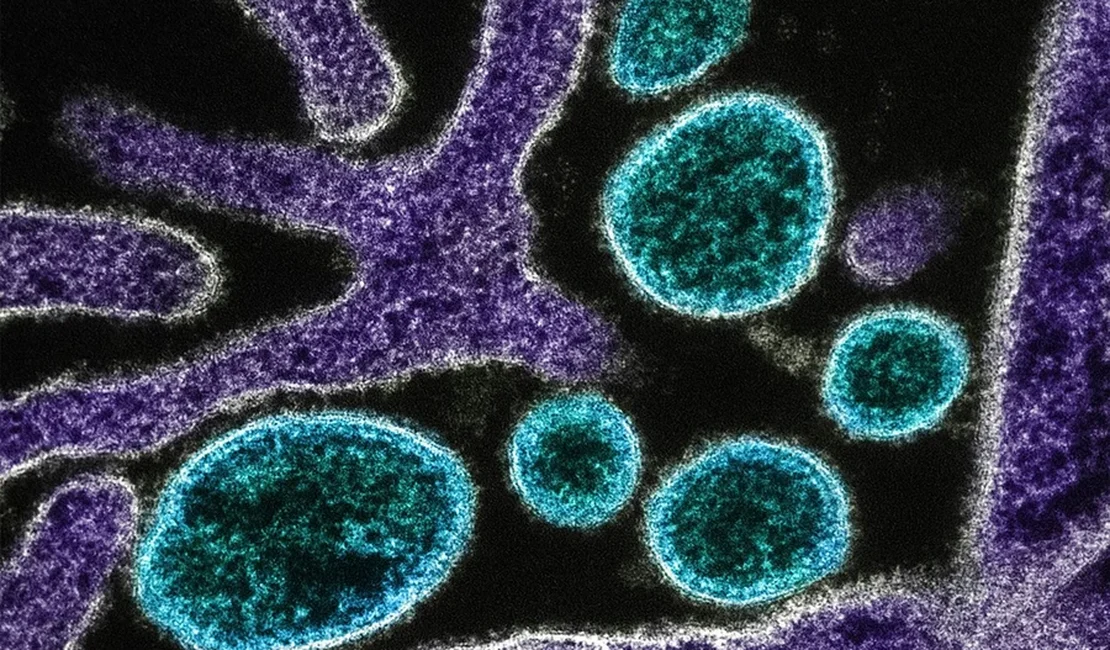 OMS confirma morte por vírus Nipah em Bangladesh