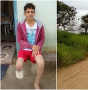 Servidor que amputou o próprio pé alegou que perdeu membro em sequestro