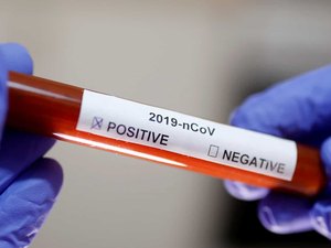 Califórnia declara estado de emergência após primeira morte por coronavírus