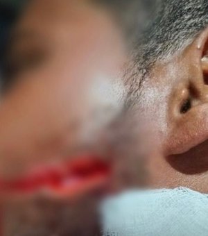 Jovem é atingido por facada no rosto durante vaquejada em Delmiro Gouveia