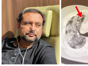 'Milagre', diz Geraldo Luís ao exibir exame do pulmão afetado por covid