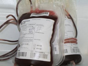 Hemoal está com menos de 50% do estoque de sangue mínimo necessário