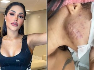 Flay diz que ganhou 10 kg e espinhas com 'chip da beleza': 'Foi o chip da feiura'