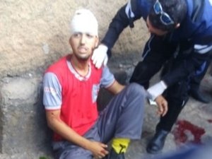 Colisão entre carro e moto pode ter causado traumatismo craniano em motociclista