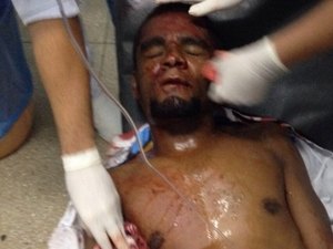 Homem sofre atentado a bala em Teotônio Vilela