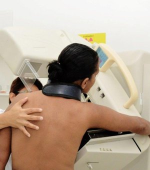 Sesau destaca importância do diagnóstico precoce de câncer de mama