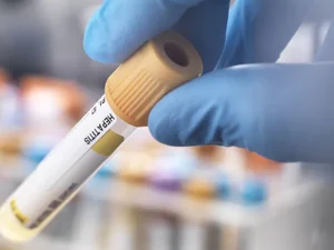 Saúde investiga nove casos de hepatite aguda infantil no Brasil
