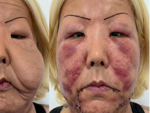 Conheça Juju do Pix, influenciadora que passa por reconstrução facial