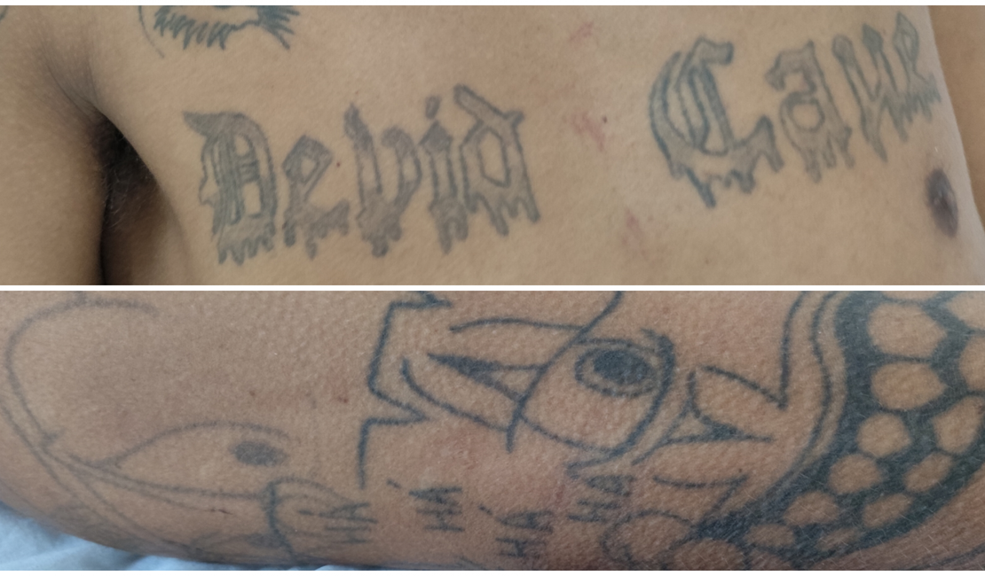 Hospital de Emergência do Agreste procura familiares de paciente identificado apenas como Rafael