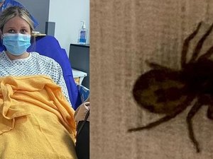 Estudante quase perde o braço após ser picada por aranha assustadora